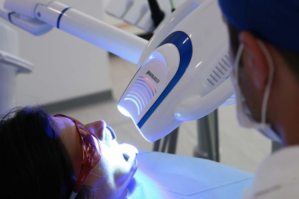 Tratament estetic la Implantodent